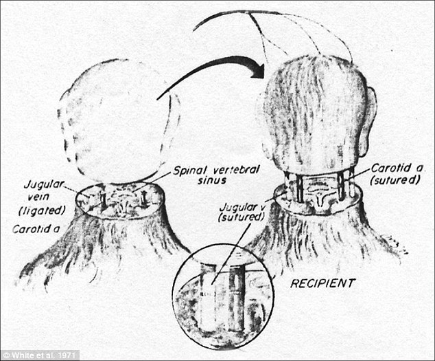 History: In 1970 Dr Robert White transplanted the head of one monkey onto the body of another, as shown in this diagram. IfMr Spiridonov's head were to be successfully transplanted his jugular vein and spinal cords would have to be similarly fused with those of his new donor body